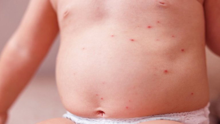 Dermatología Pediátrica