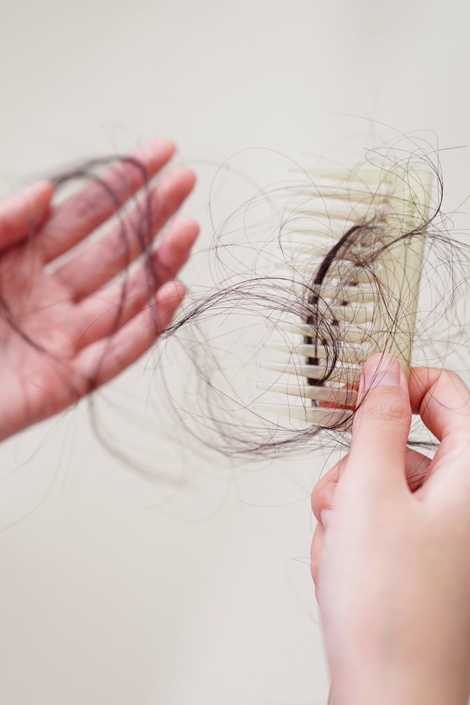 Caída de cabello en el hombre y en la mujer Caída de cabello en el hombre y en la mujer