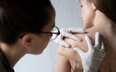 ¿Cuándo conviene ir al dermatólogo? Señales que no debés ignorar
