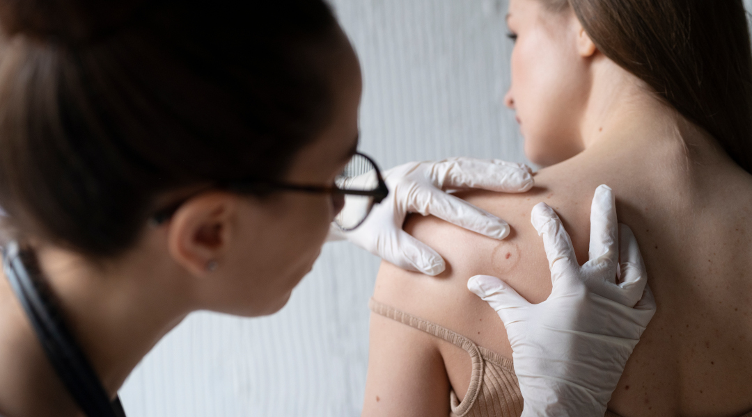 Señales para consultar al dermatólogo en Buenos Aires