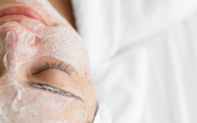 Peeling químico para manchas en la piel: ¿es para vos?