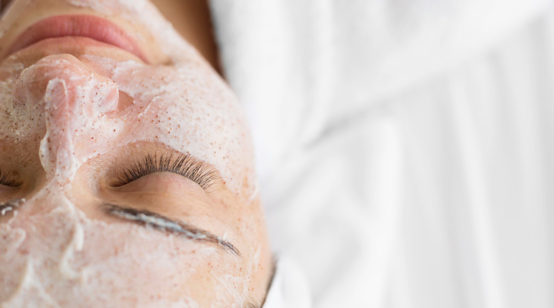 Aplicación de peeling químico para tratar manchas en la cara