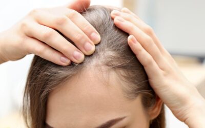 ¿Qué pasa si no tratás a tiempo la caída del cabello?