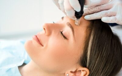 Tratamientos estéticos avanzados: Dermapen, Mesoterapia, Radiesse y más