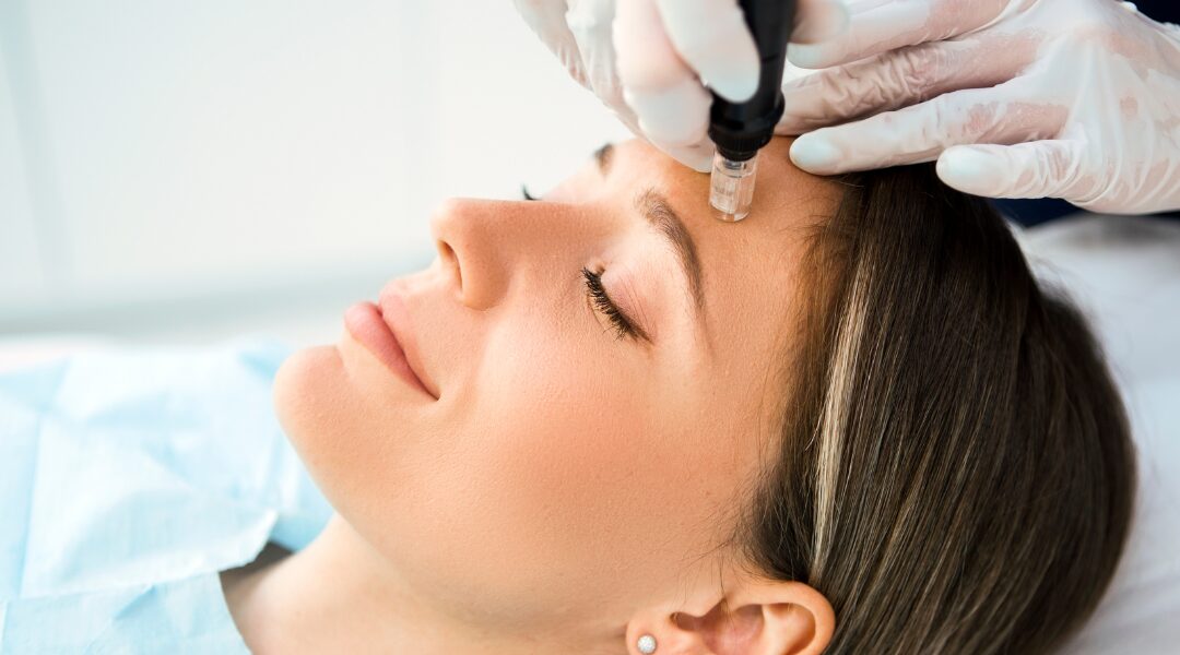 Tratamientos estéticos Dermapen, Mesoterapia y Radiesse en Experiencia Piel para rejuvenecimiento facial